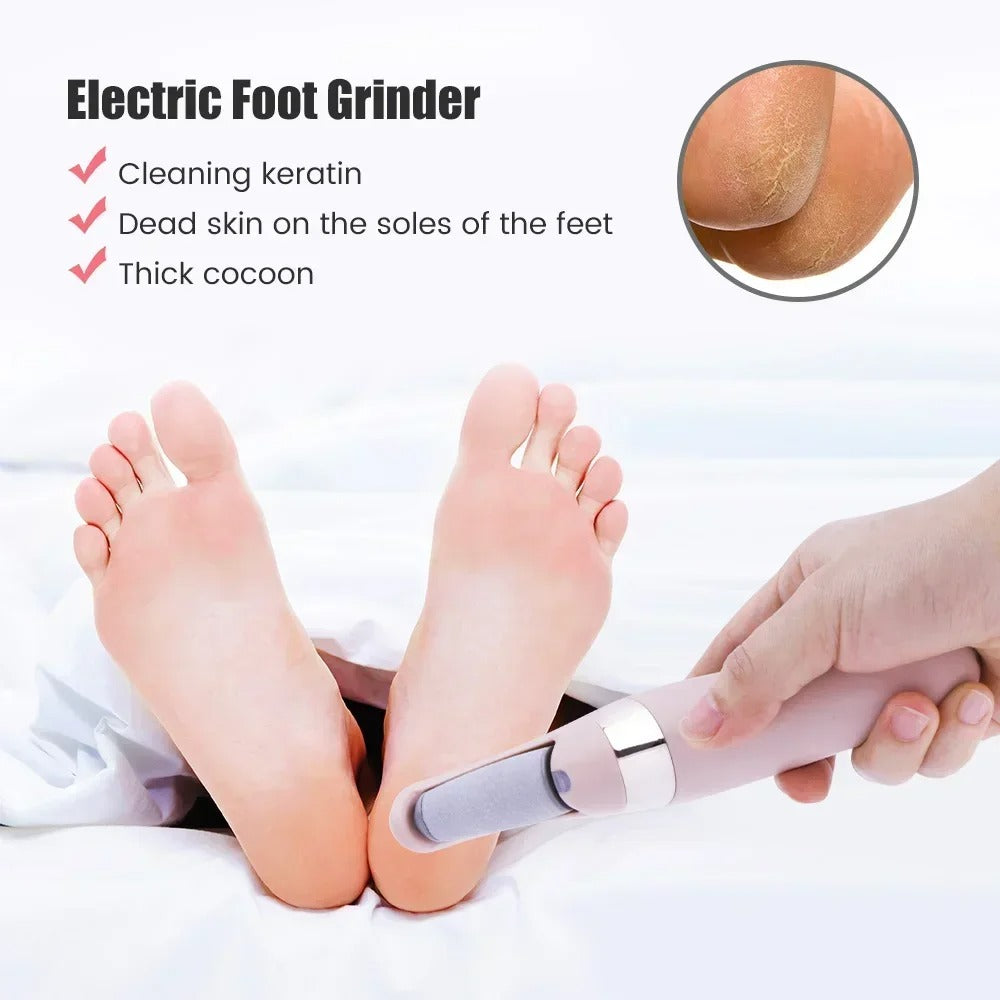 Electric Foot Callus Remover & Grinder – Rechargeable Foot File with Vacuum for Cracked Heels & Dead Skin